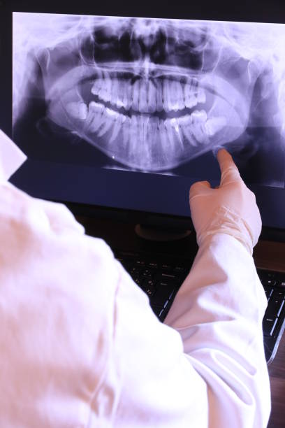 Best Knocked-Out Tooth (Avulsed Tooth) Treatment in Lofall, WA